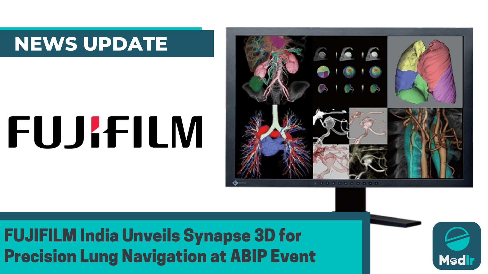 FUJIFILM India Unveils Synapse 3D for Precision Lung Navigation at ABIP ...