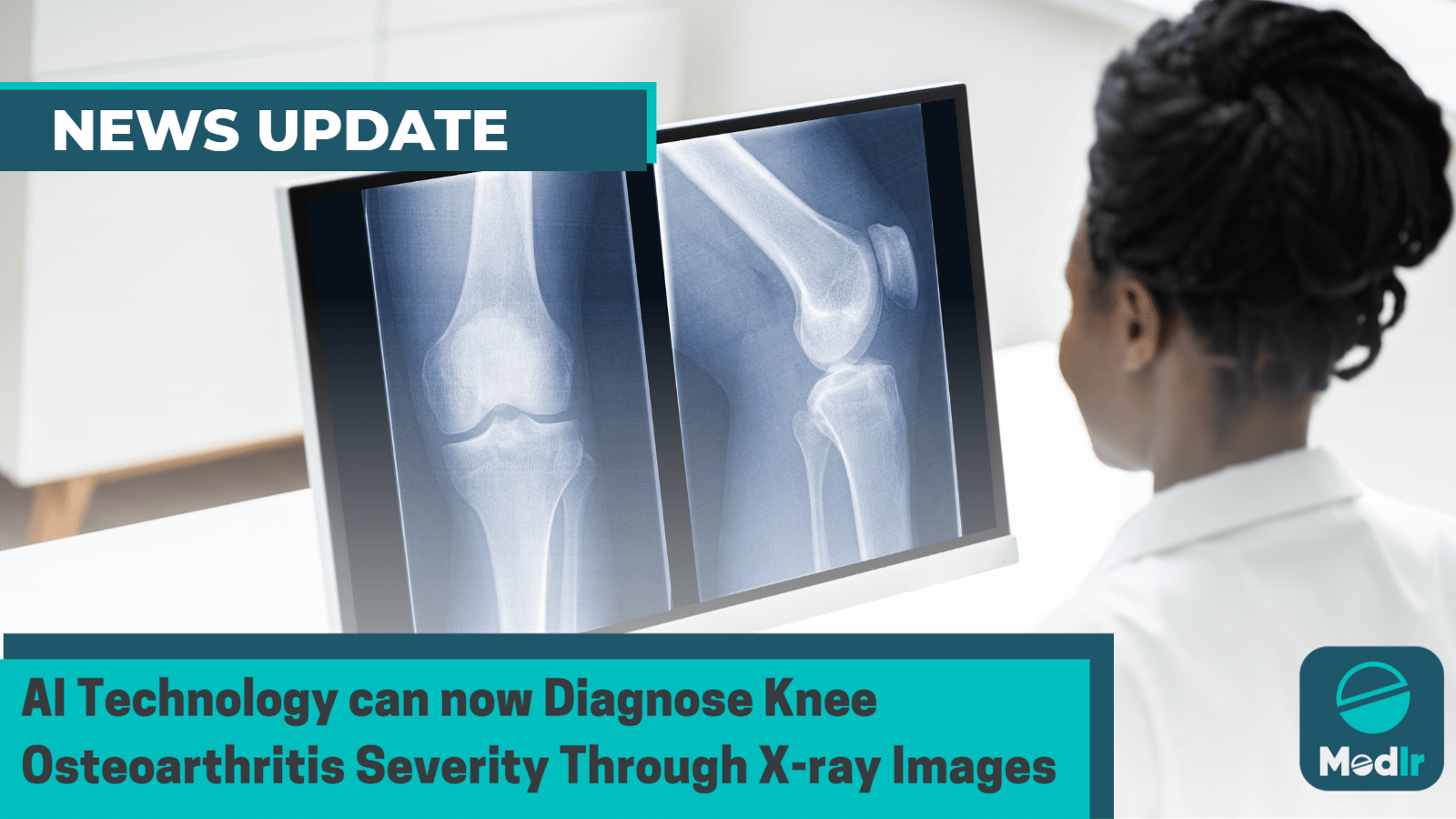 AI Technology can now Diagnose Knee Osteoarthritis Severity Through X-ray Images