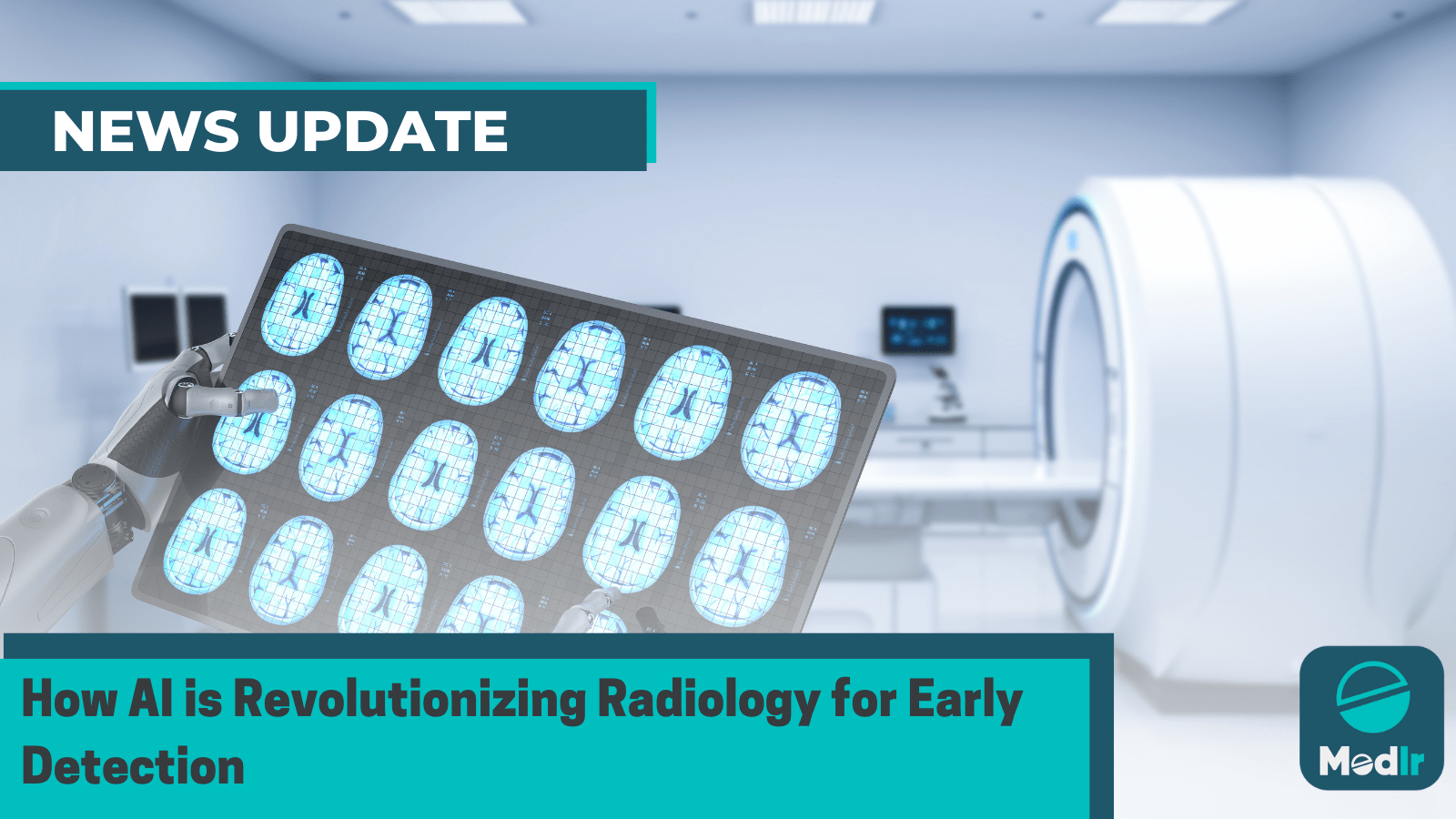 How AI is Revolutionizing Radiology for Early Detection