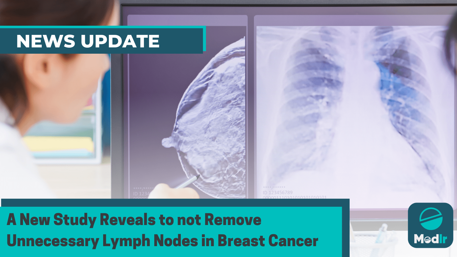 A New Study Reveals to not Remove Unnecessary Lymph Nodes in Breast Cancer