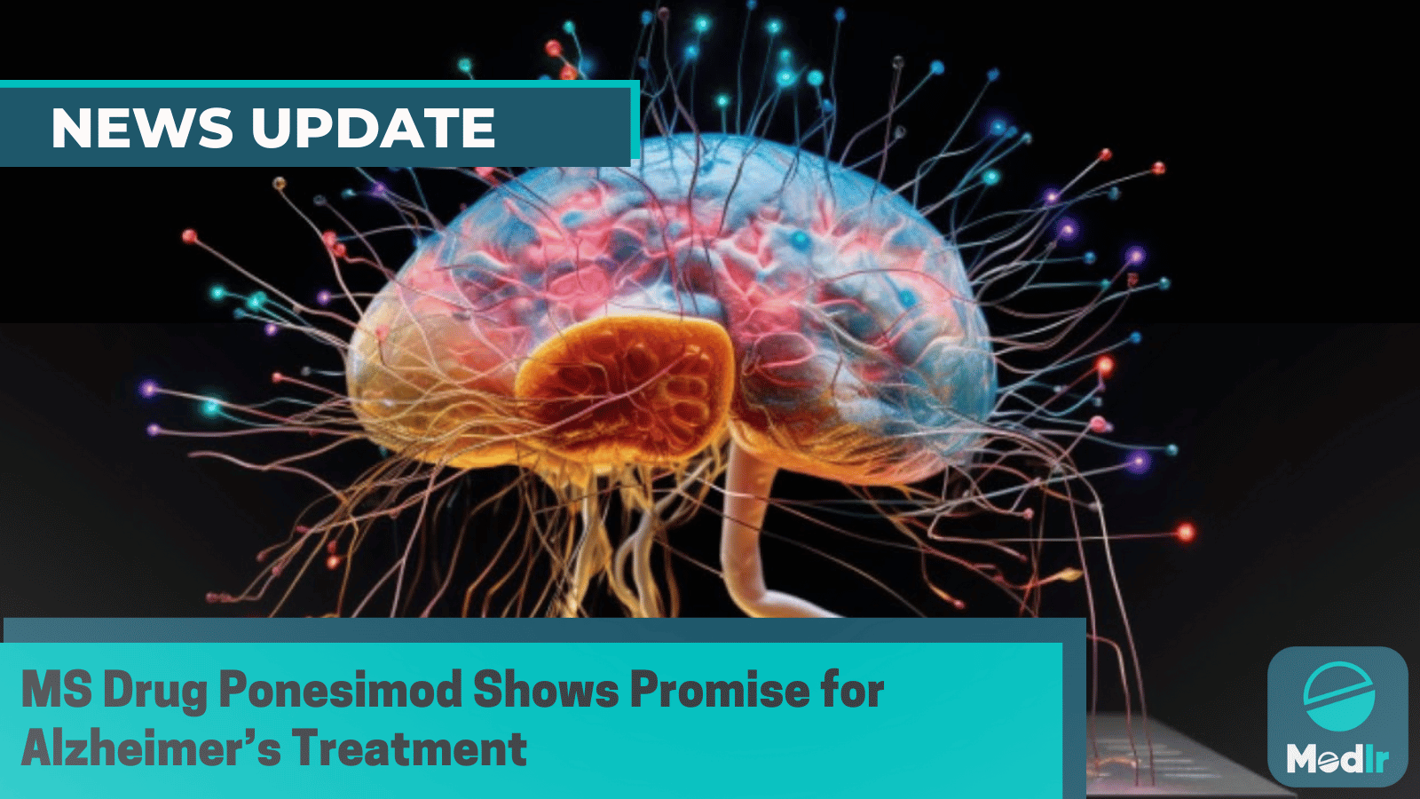 MS Drug Ponesimod Shows Promise for Alzheimer’s Treatment