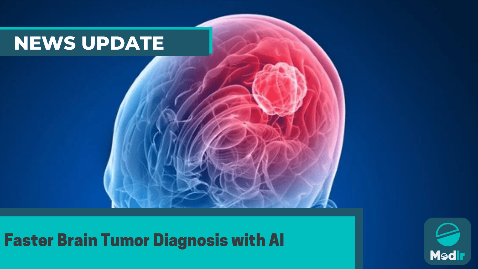 Faster Brain Tumor Diagnosis with AI