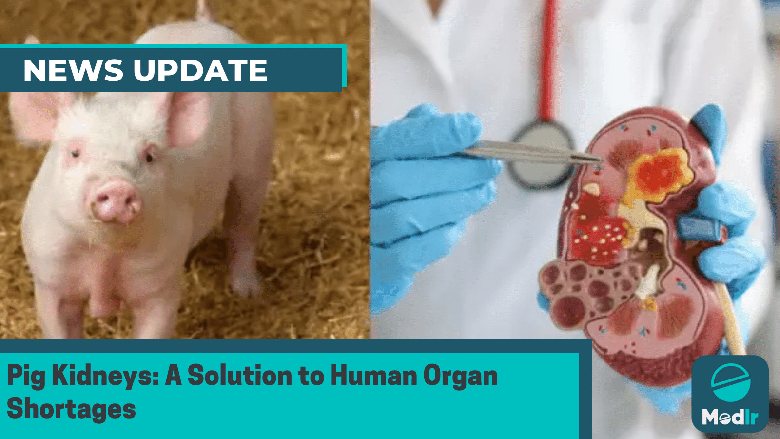 Pig Kidneys: A Solution to Human Organ Shortages