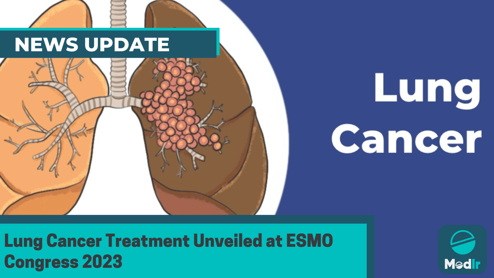 Lung Cancer Treatment Unveiled at ESMO Congress 2023