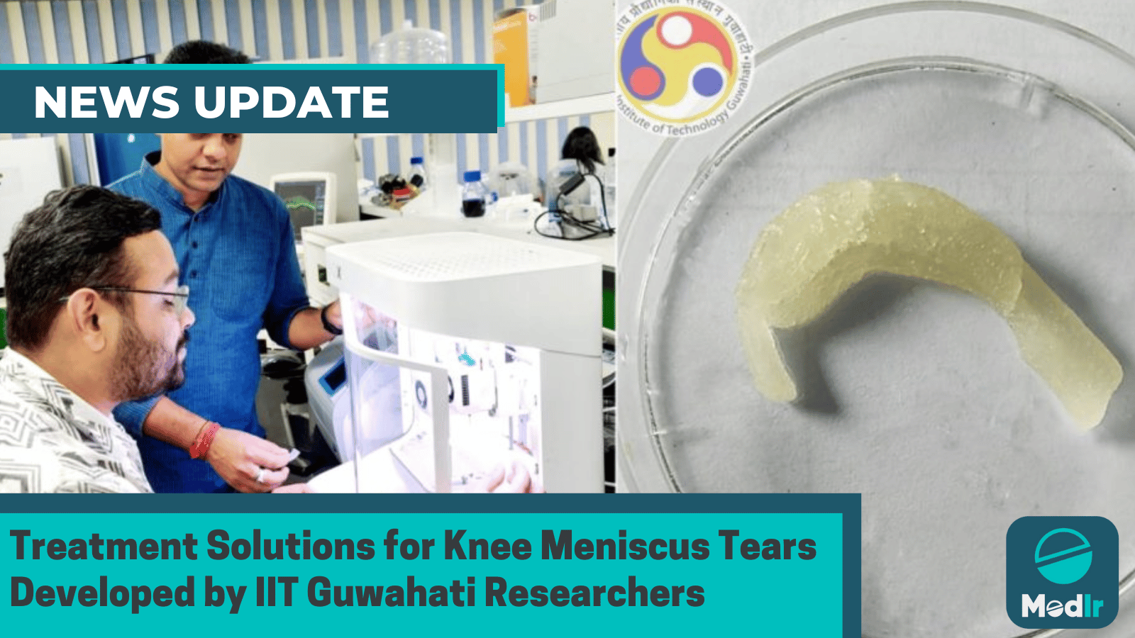 Treatment Solutions for Knee Meniscus Tears Developed by IIT Guwahati Researchers