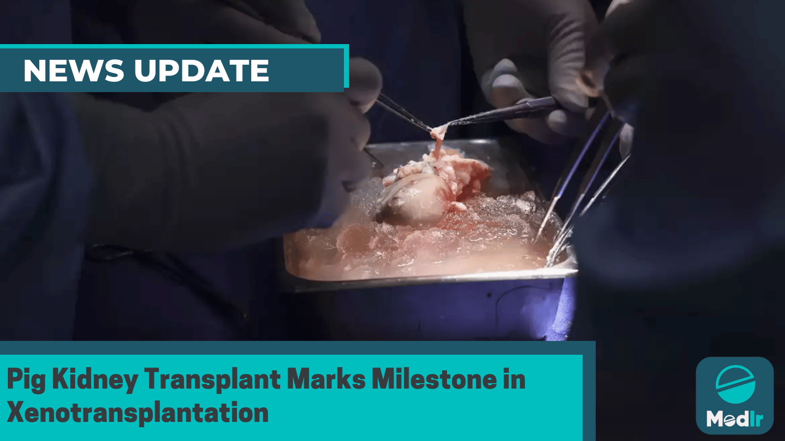 Pig Kidney Transplant Marks Milestone in Xenotransplantation