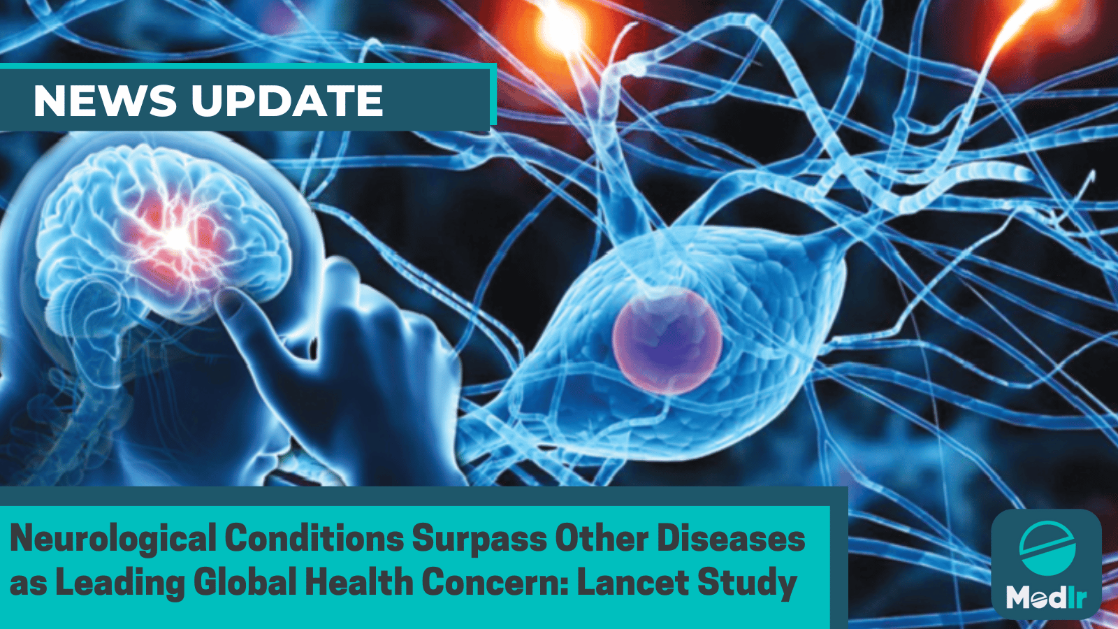 Neurological Conditions Surpass Other Diseases as Leading Global Health Concern: Lancet Study