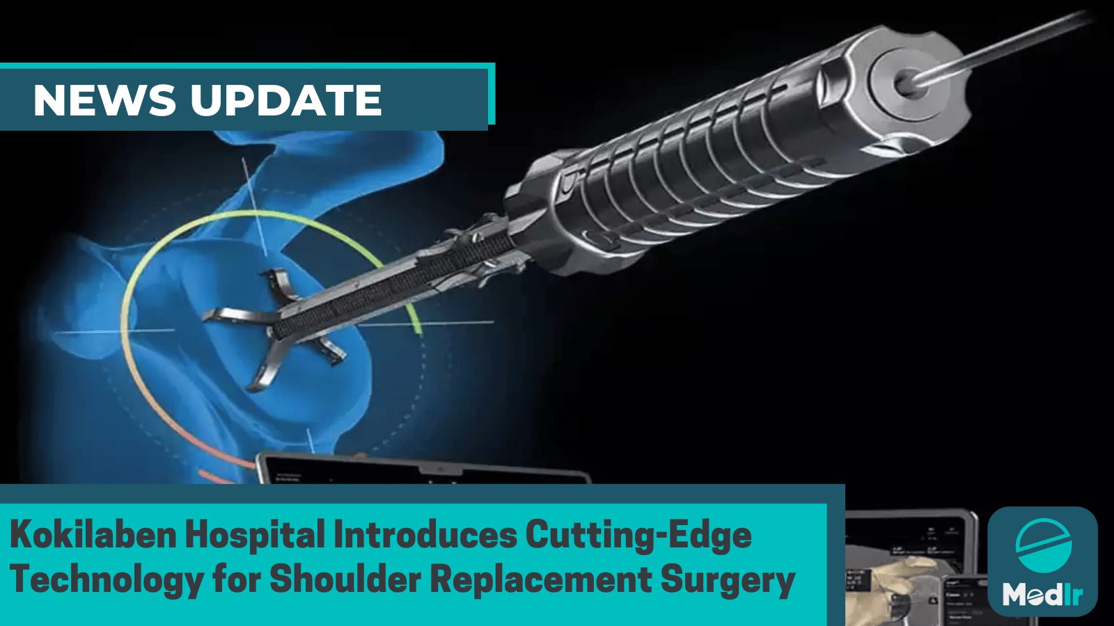 Kokilaben Hospital Introduces Cutting-Edge Technology for Shoulder Replacement Surgery