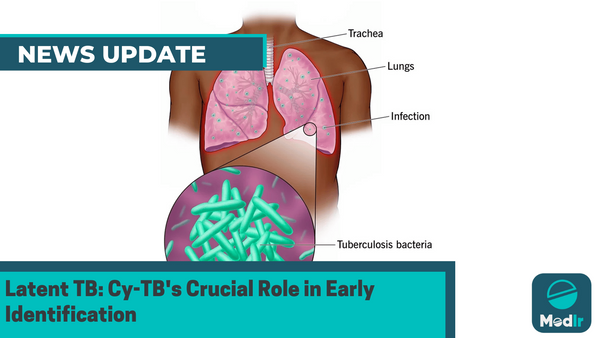 Latent TB: Cy-TB's Crucial Role in Early Identification